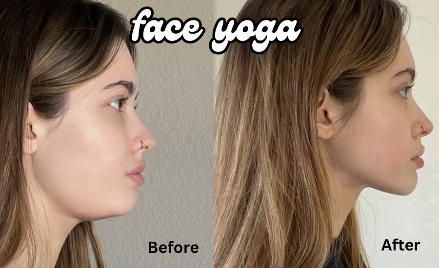 face yoga before and after