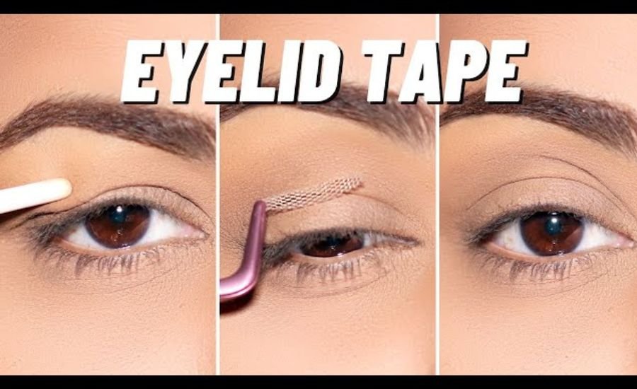 Eyelid tape