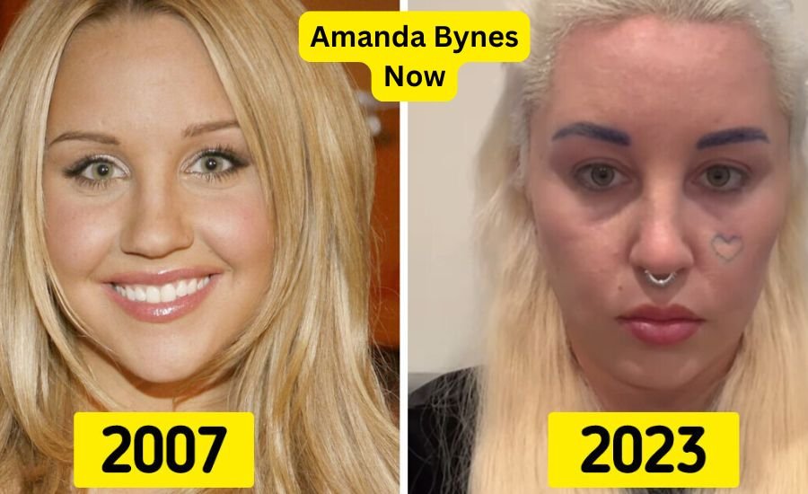 Amanda Bynes now