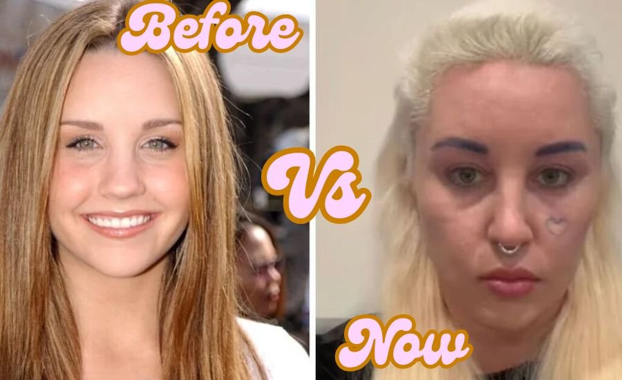 Amanda Bynes now